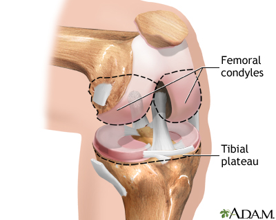 Celebrex for knee pain z pack